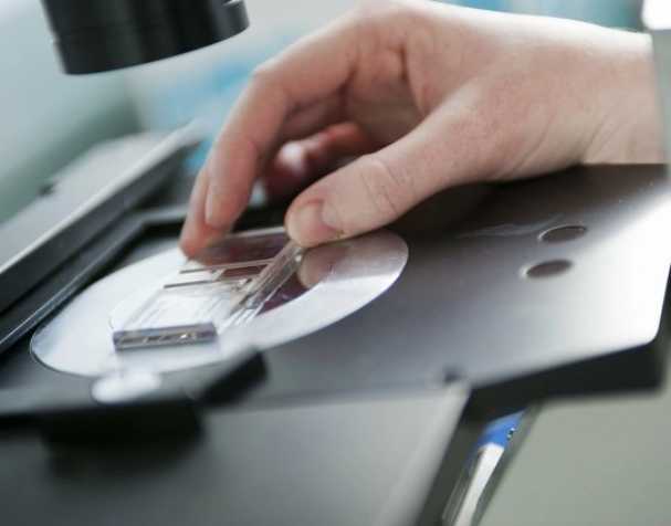 SAMe或成慢性結(jié)腸炎新希望？